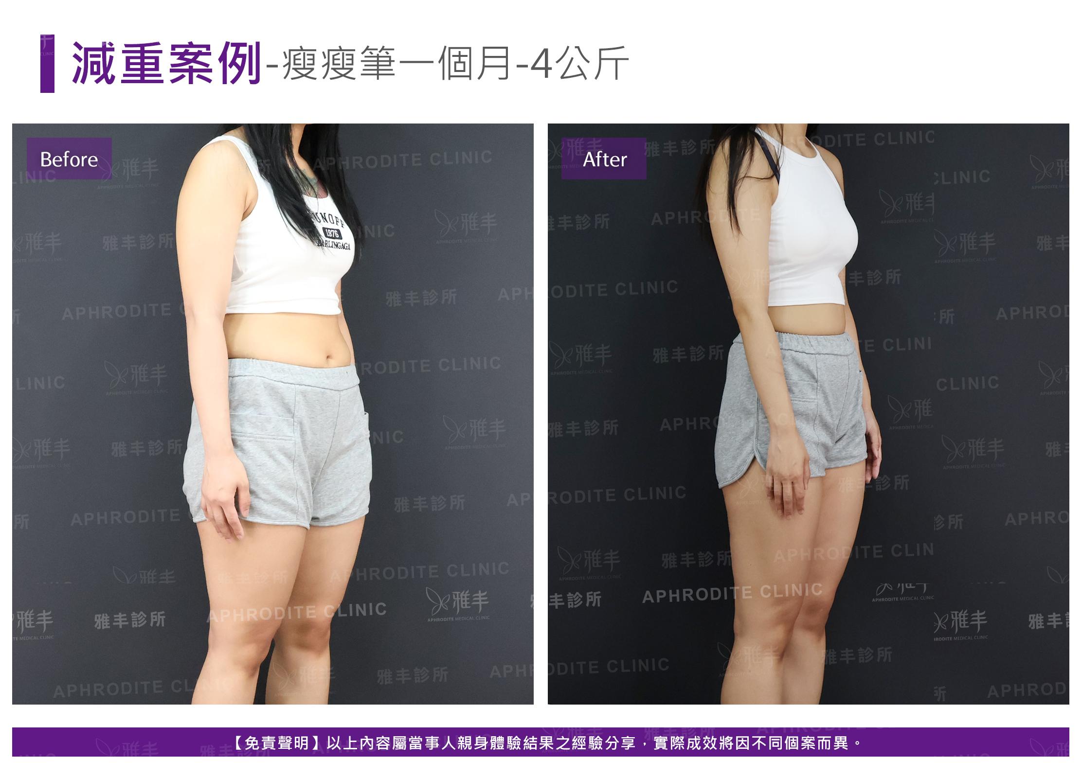 減重案例-case12-R45.jpg