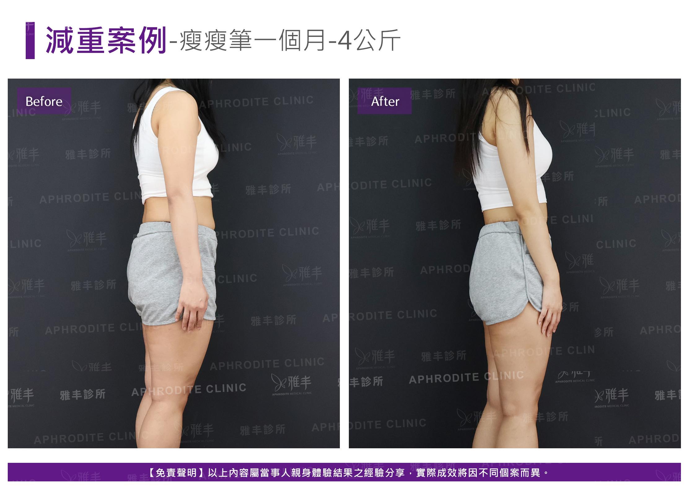 減重案例-case12-R90.jpg
