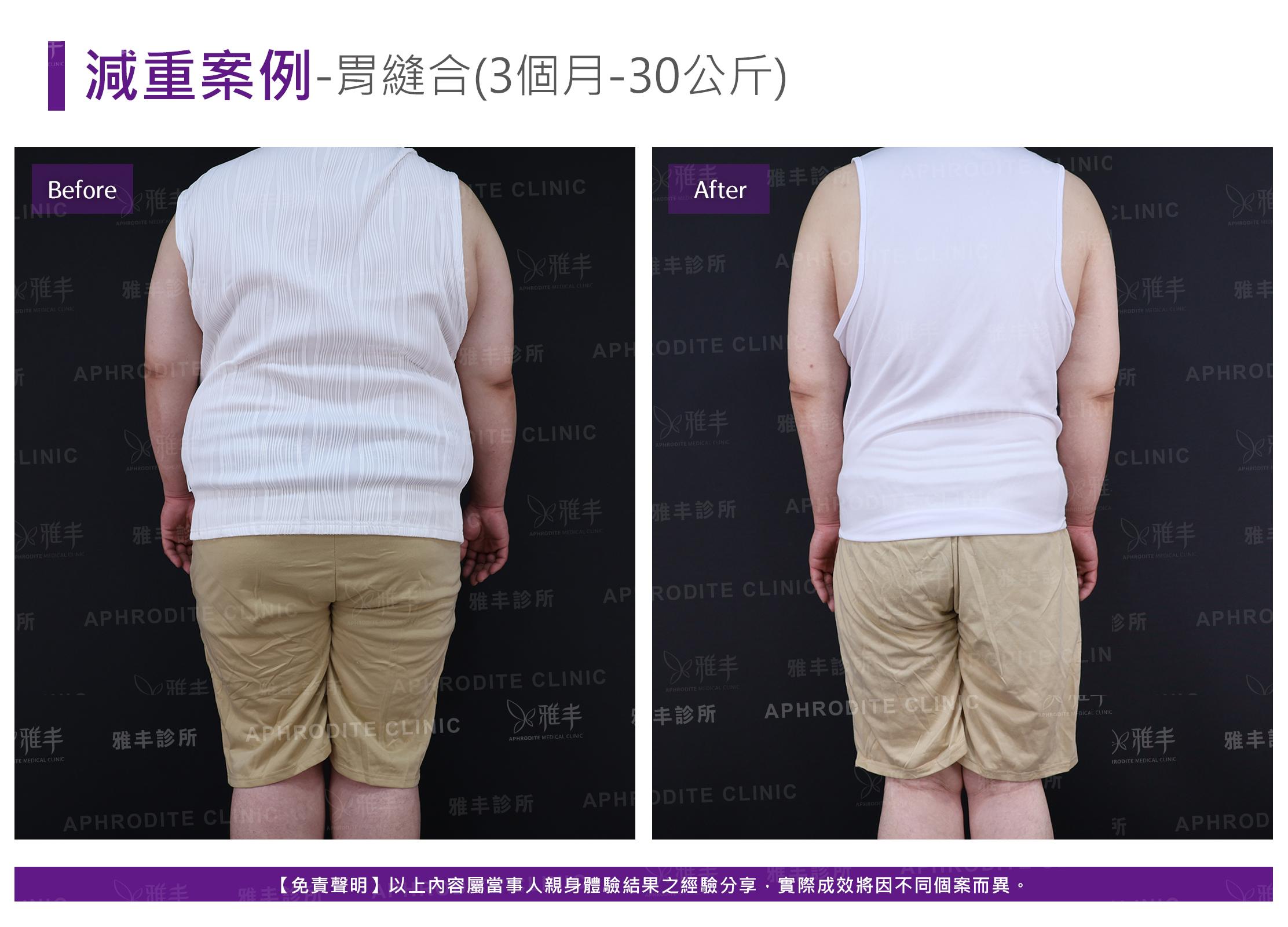 減重案例-case13-B.jpg