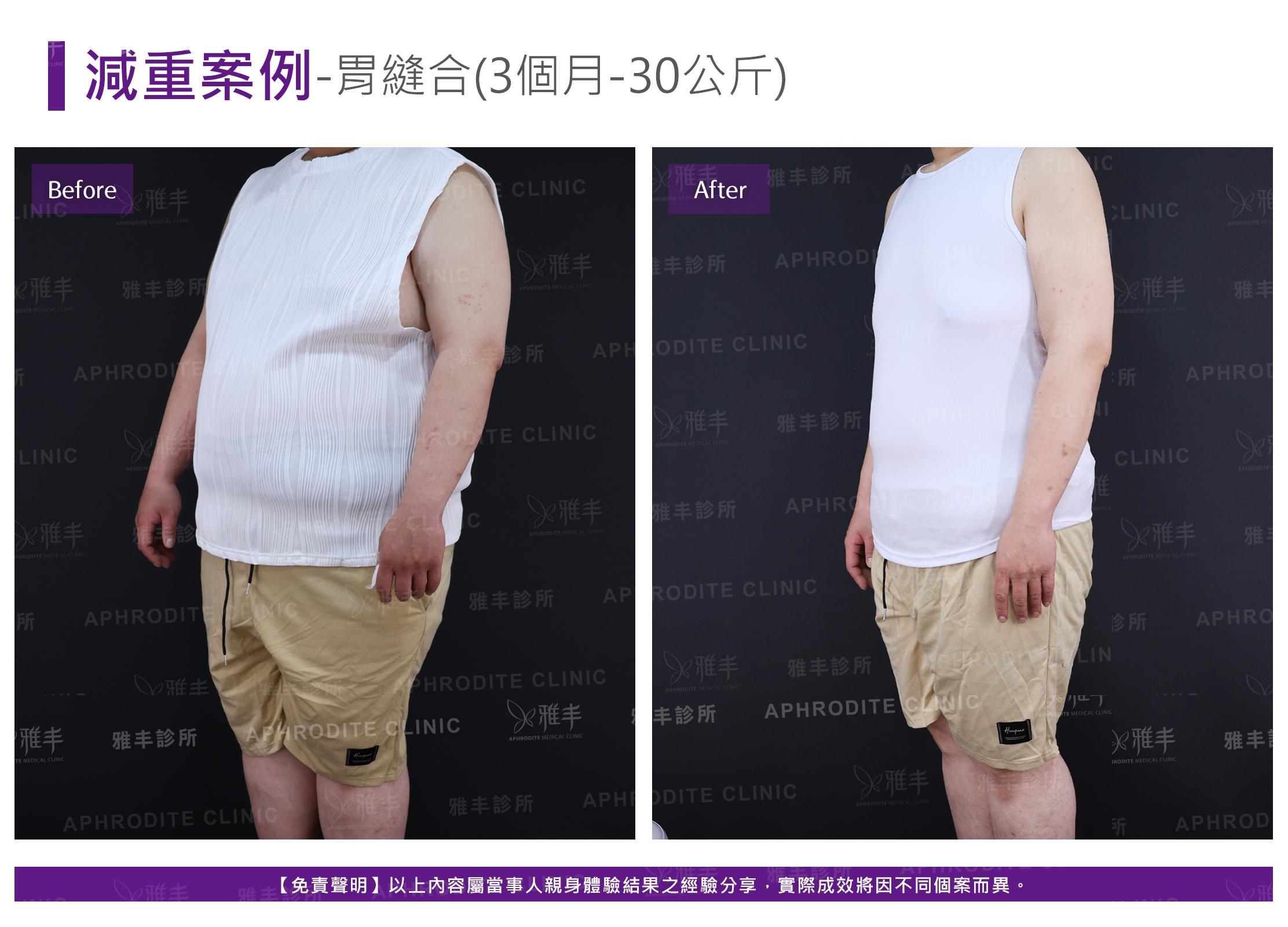 減重案例-case13-L45.jpg