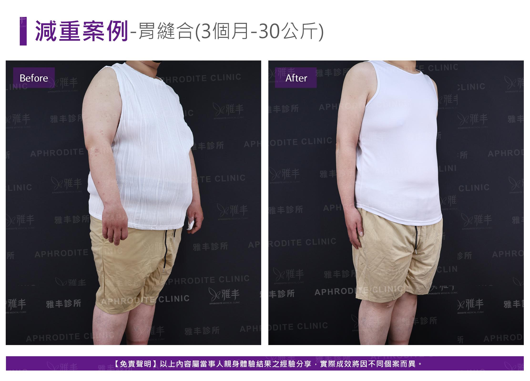 減重案例-case13-R45.jpg