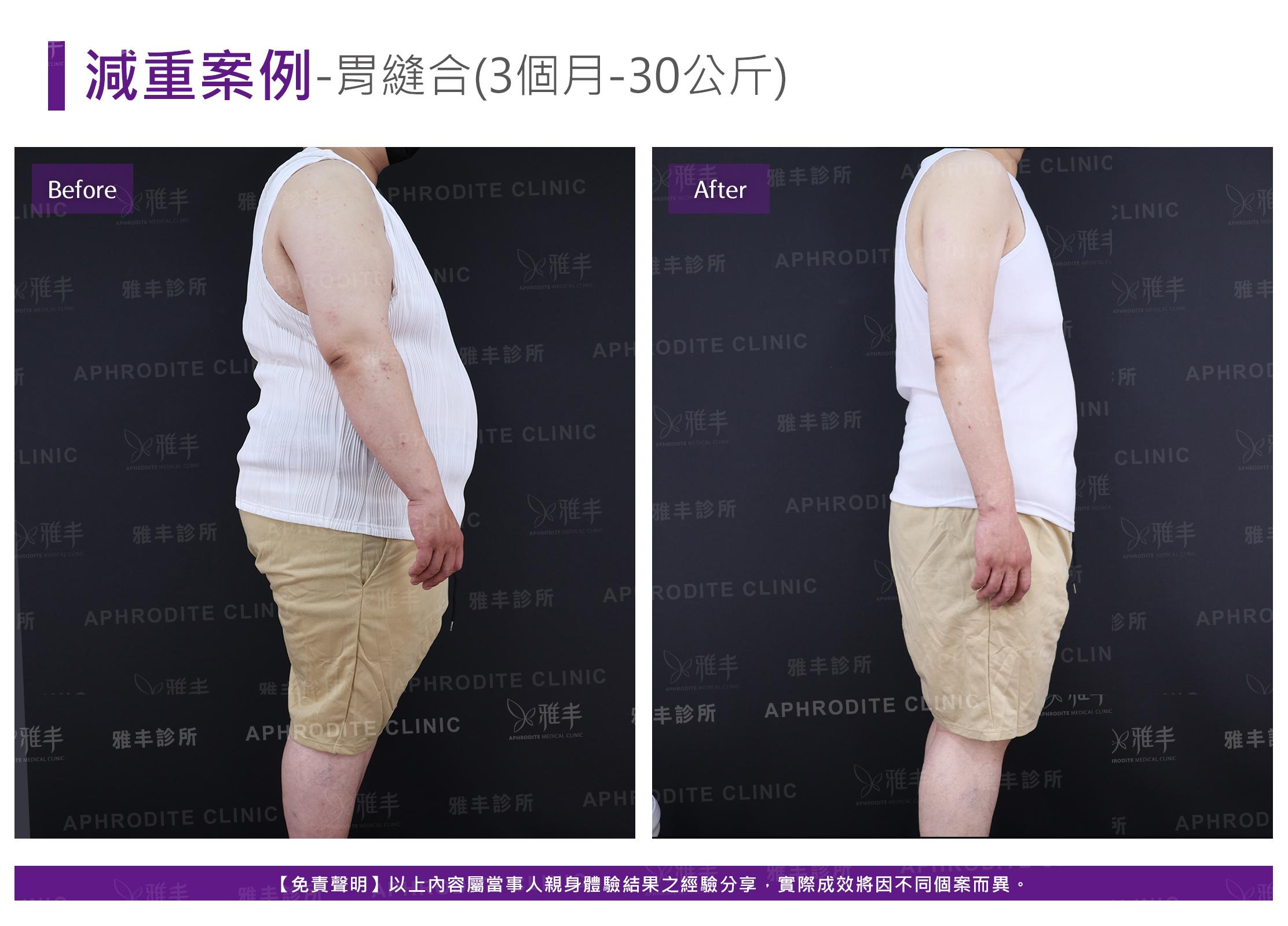 減重案例-case13-R90.jpg