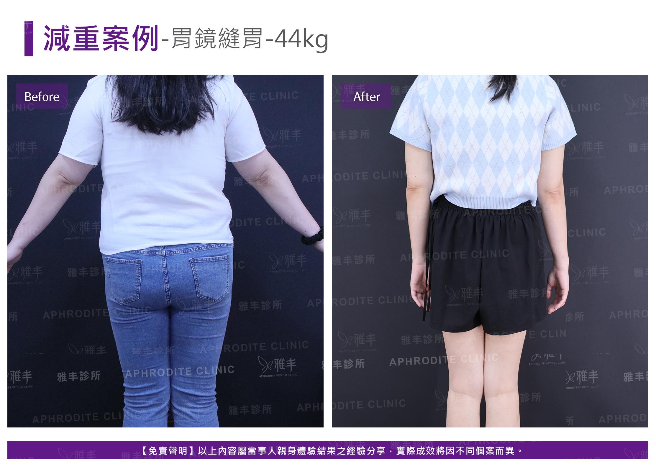 減重案例-case15-B.jpg
