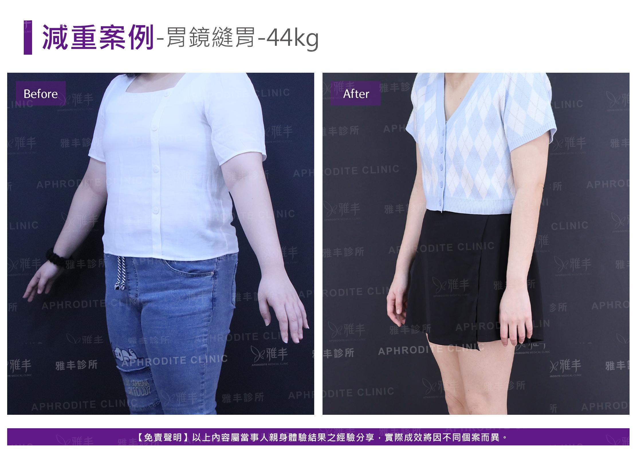 減重案例-case15-L45.jpg