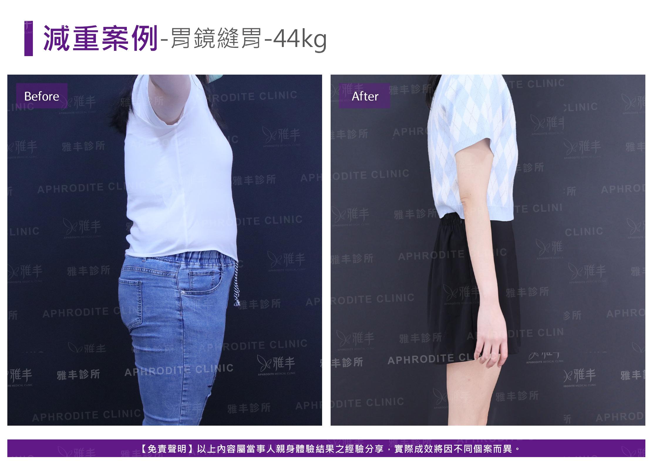 減重案例-case15-R90.jpg