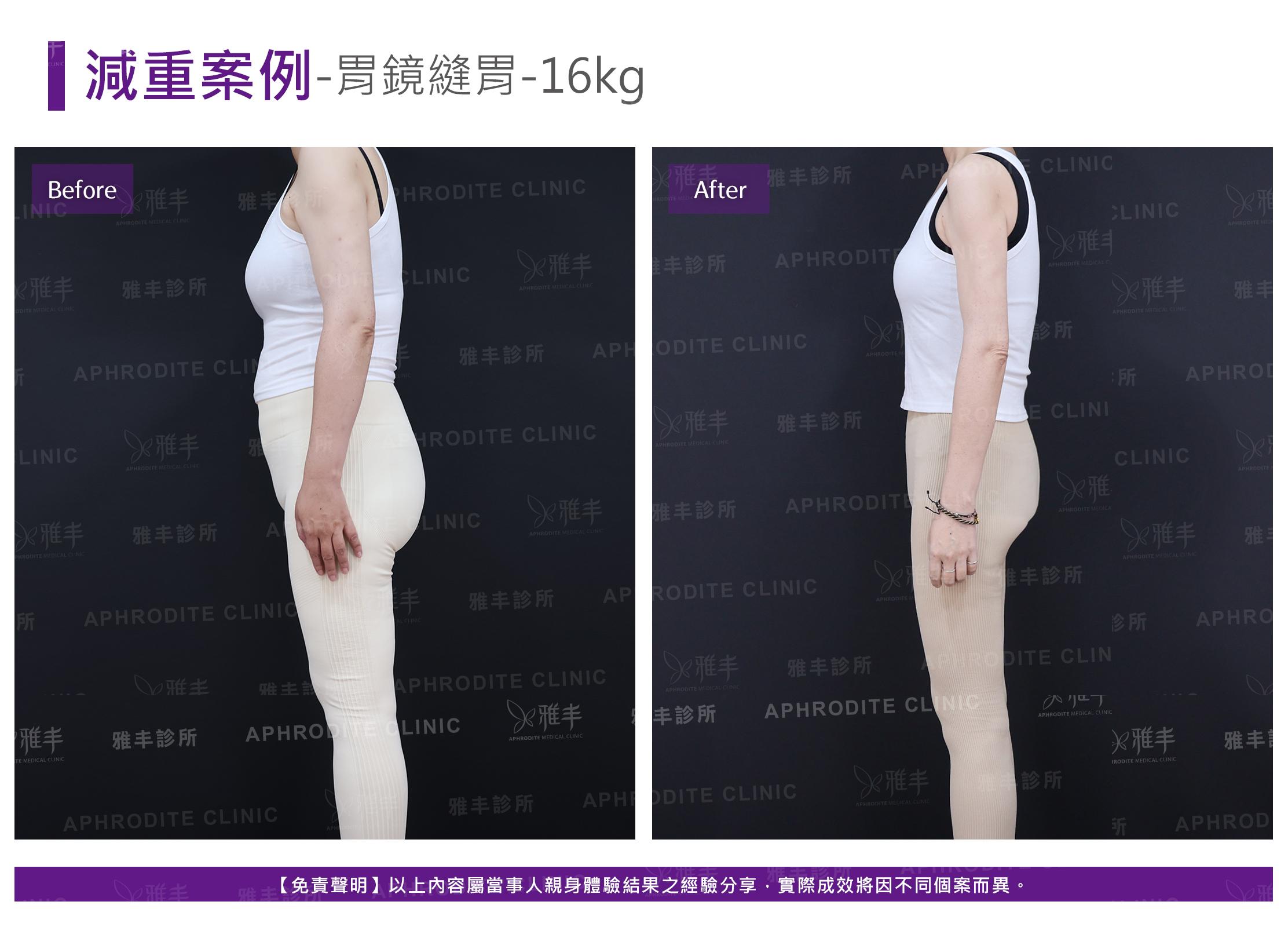 減重案例-case16-L90.jpg