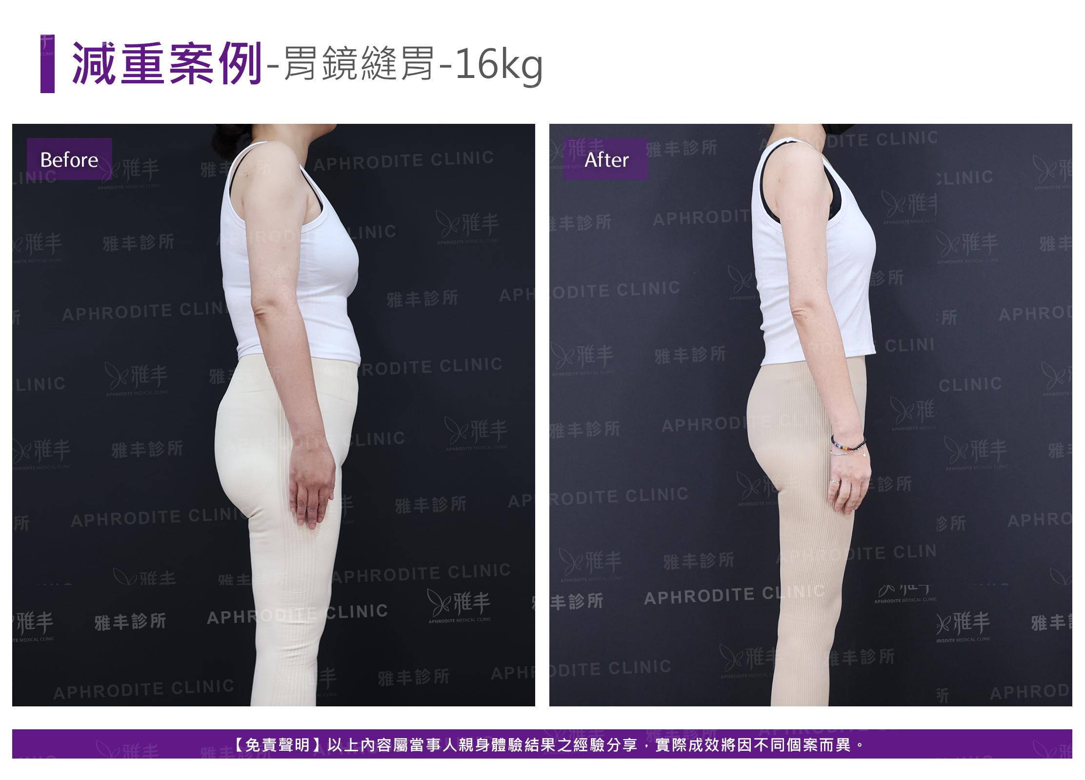 減重案例-case16-R90.jpg