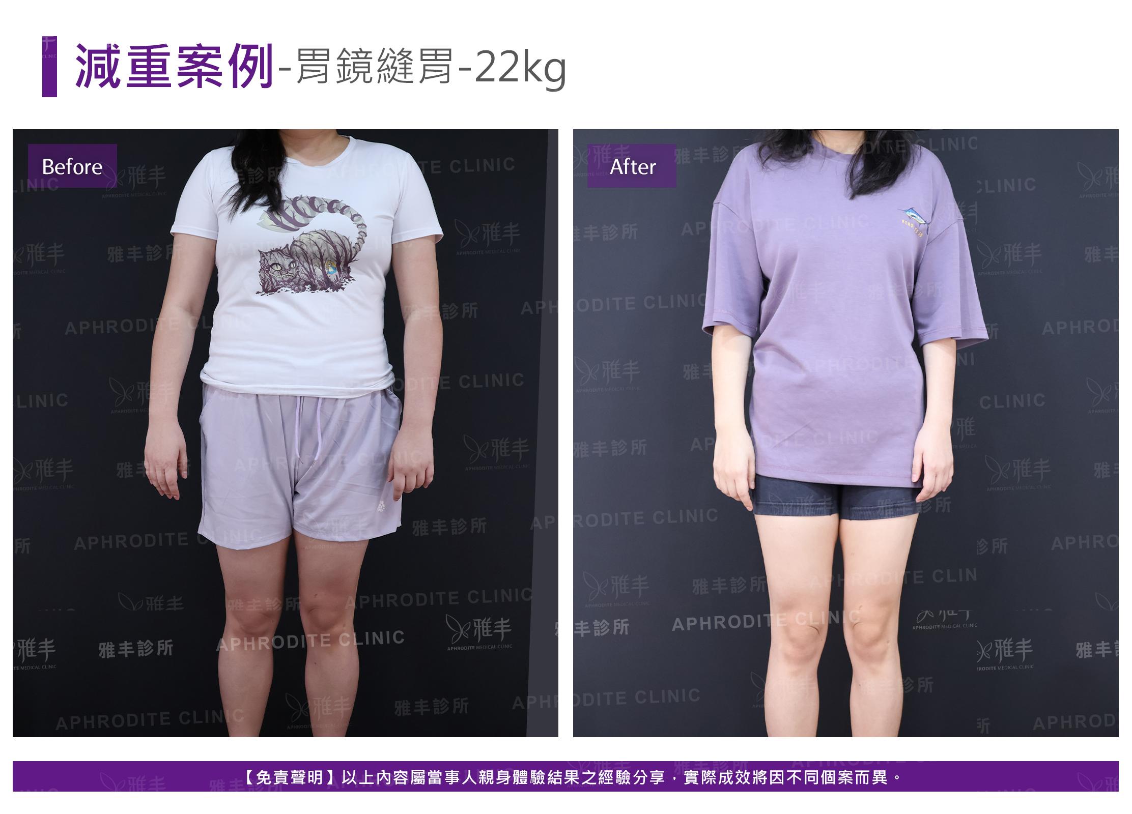 減重案例-case17-F.jpg