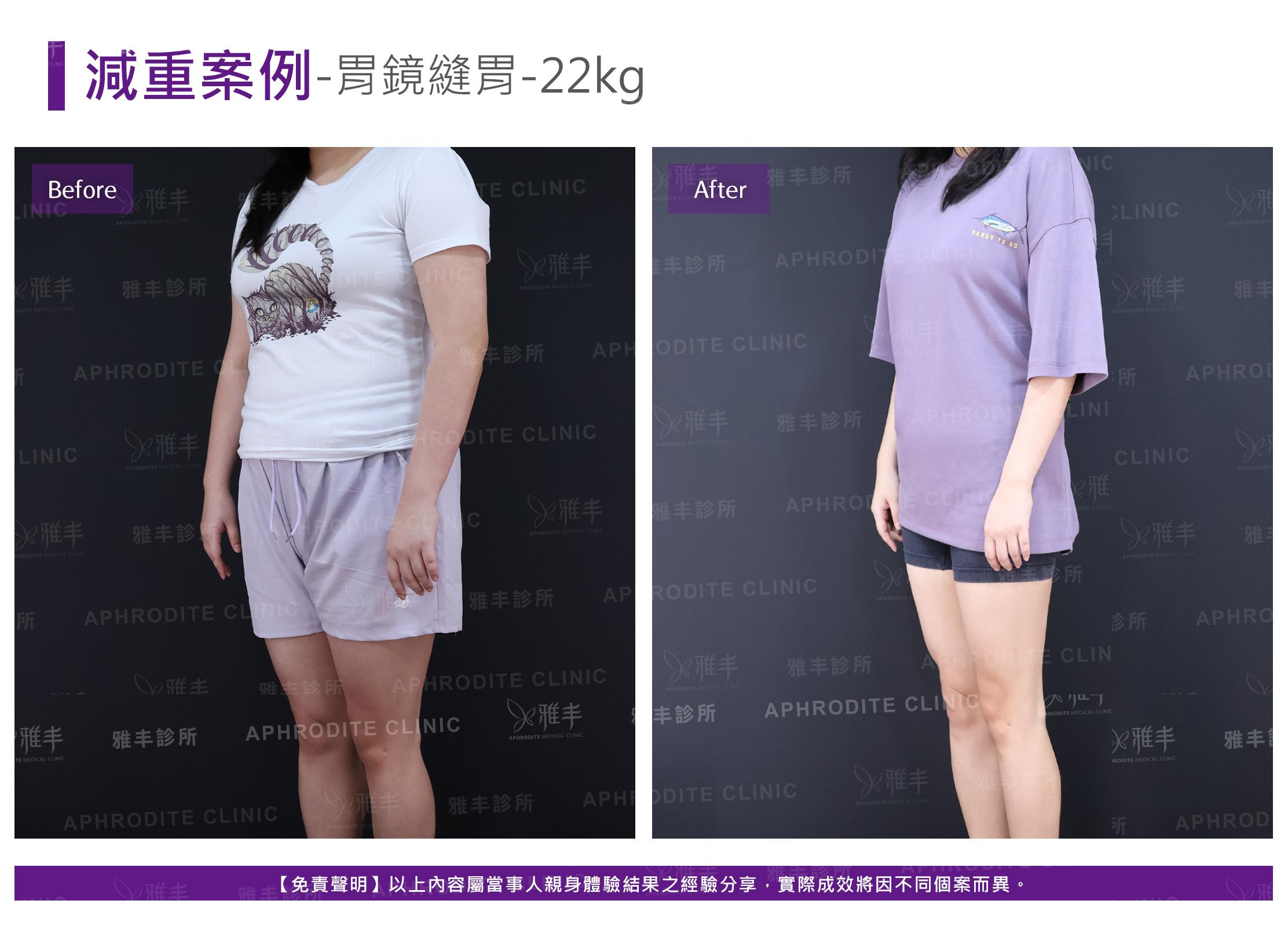 減重案例-case17-L45.jpg