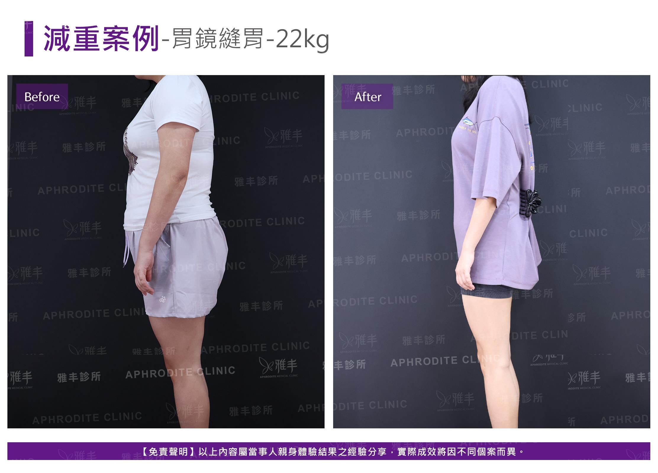 減重案例-case17-L90.jpg