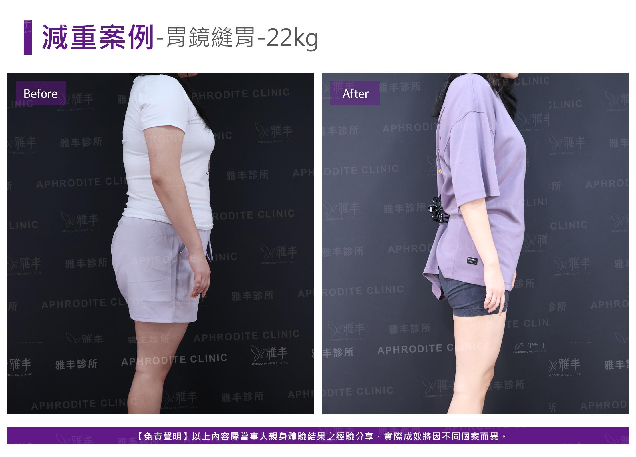 減重案例-case17-R90.jpg