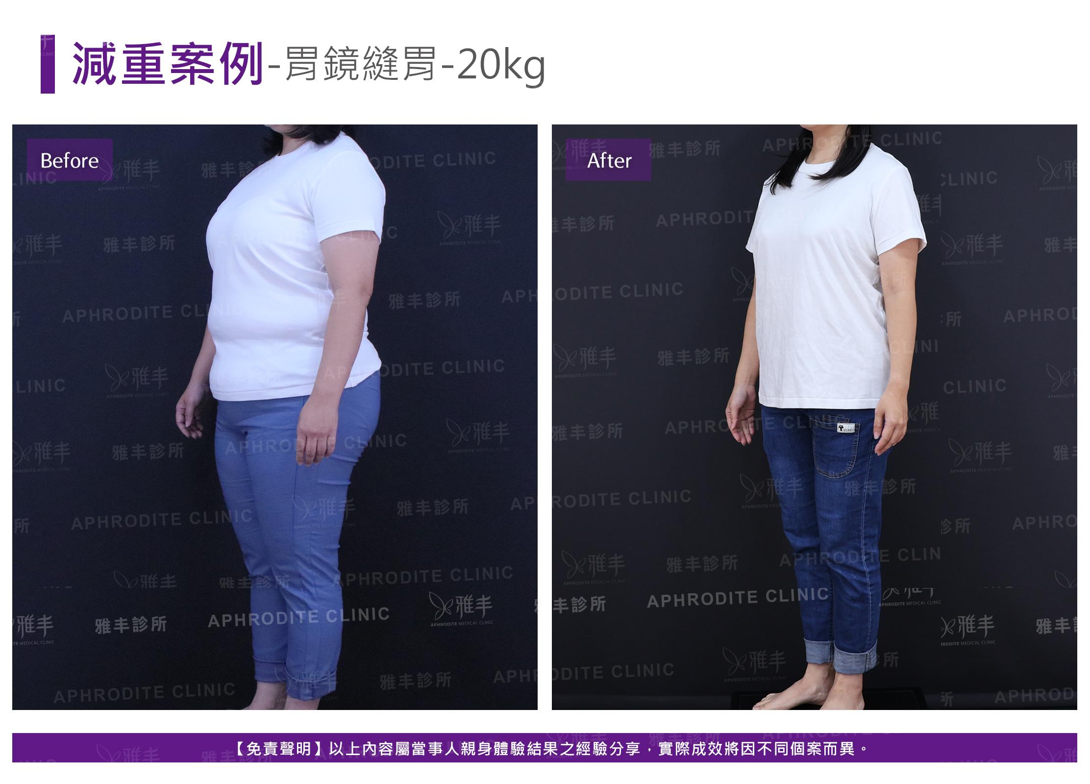 減重案例-case18-L45.jpg