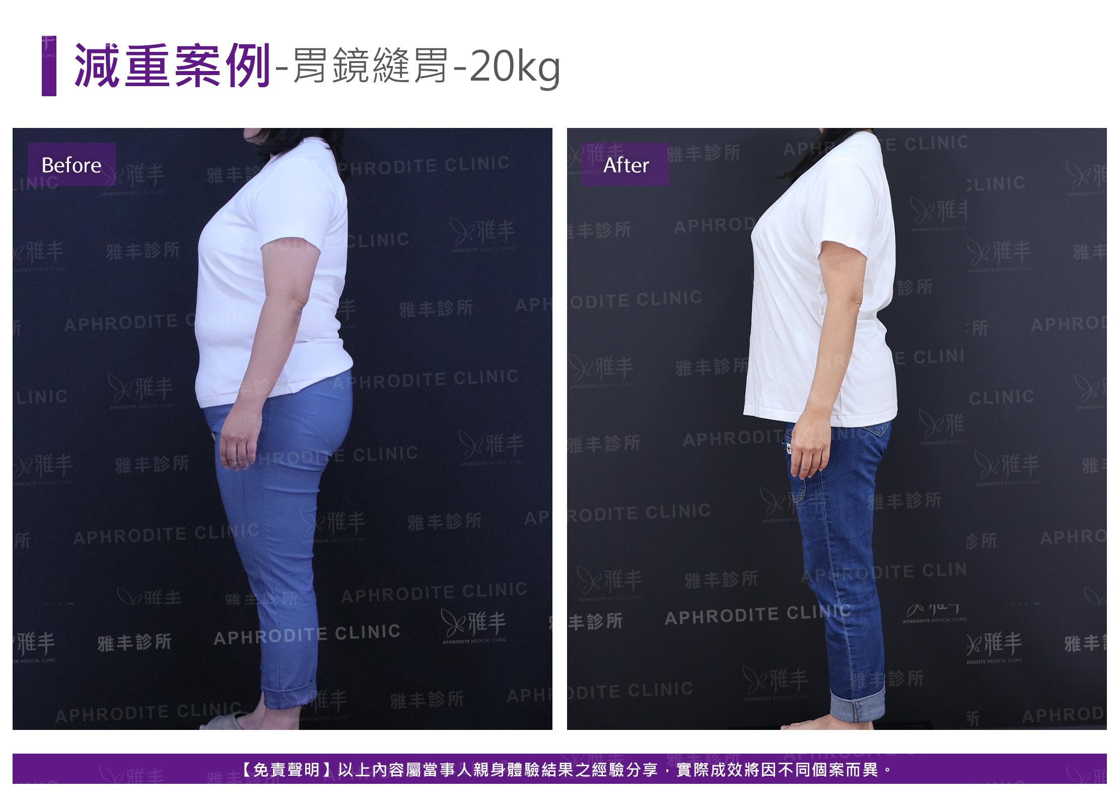 減重案例-case18-L90.jpg