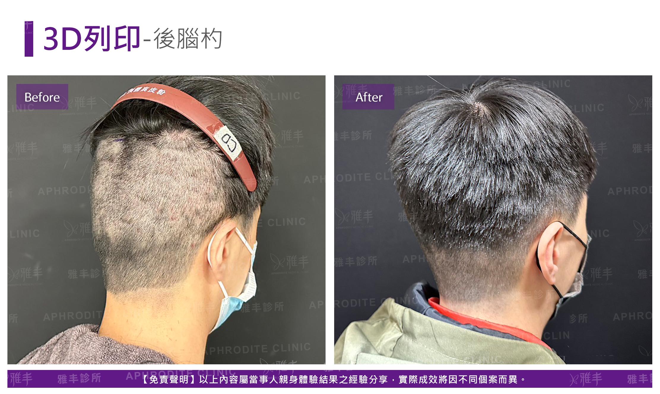 3D列印-case4-R45.jpg