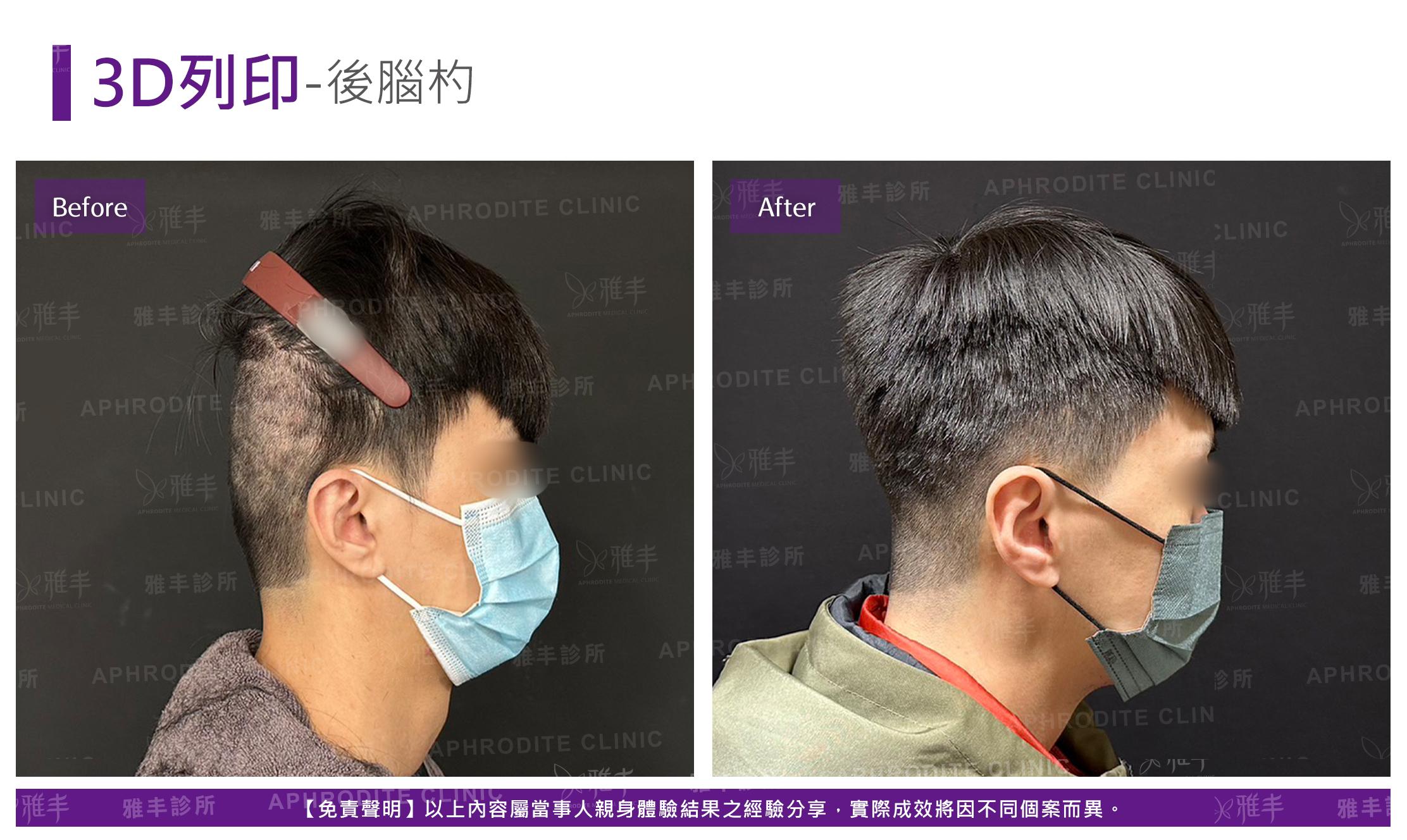 3D列印-case4-R.jpg