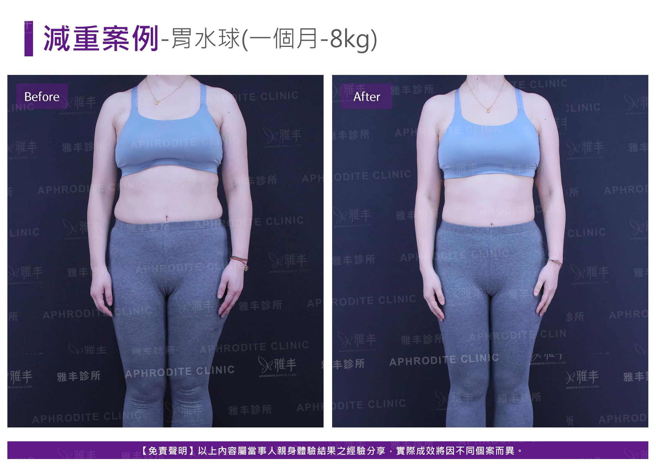 減重案例-case5-F.jpg