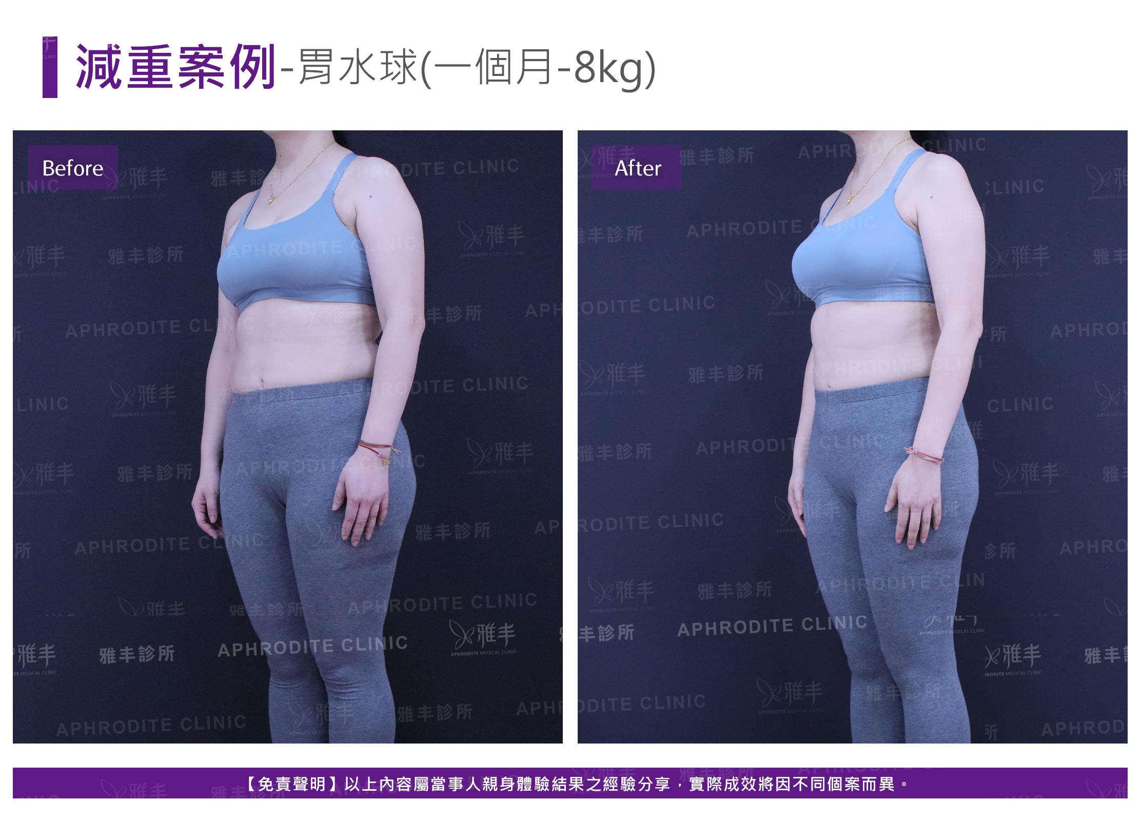 減重案例-case5-L45.jpg