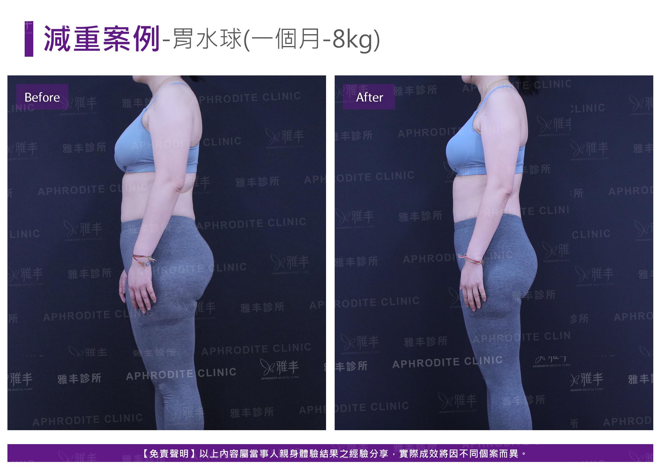 減重案例-case5-L90.jpg