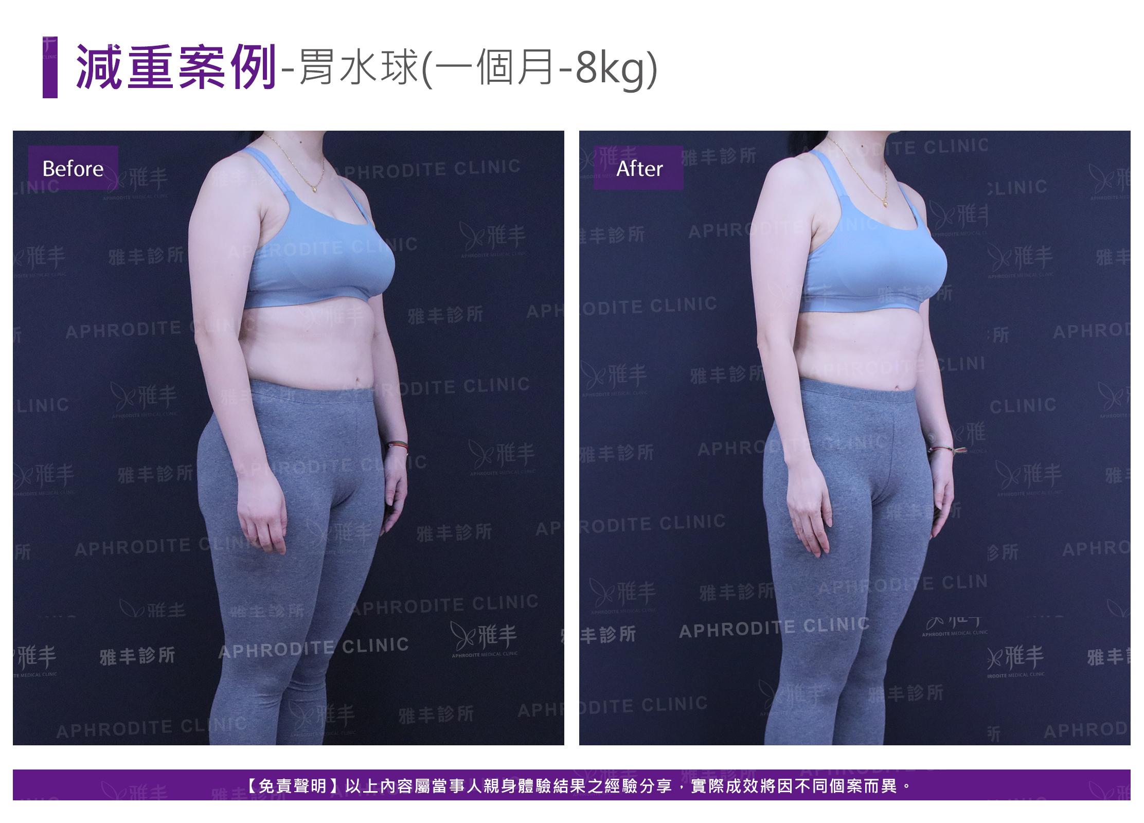 減重案例-case5-R45.jpg
