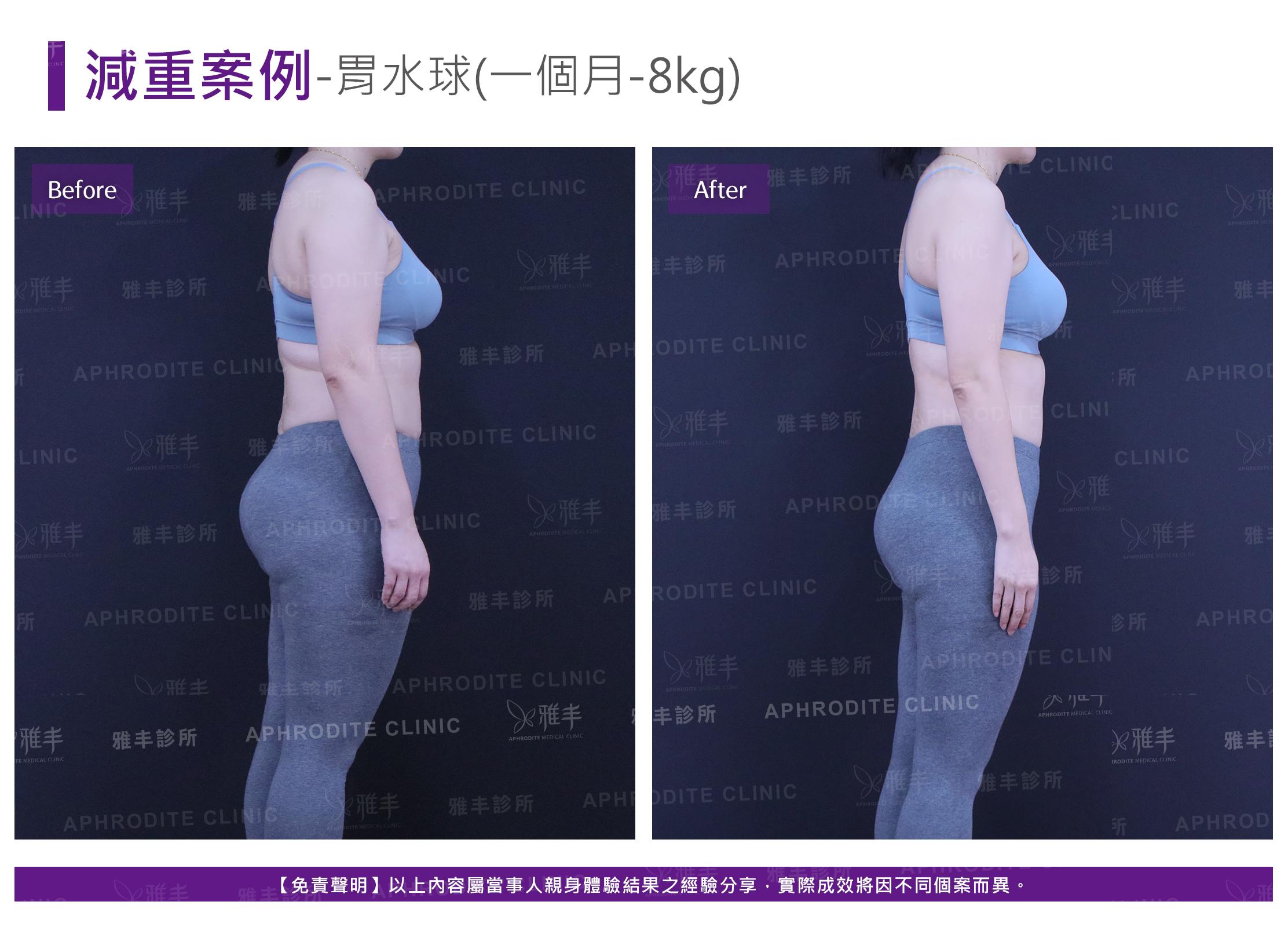 減重案例-case5-R90.jpg