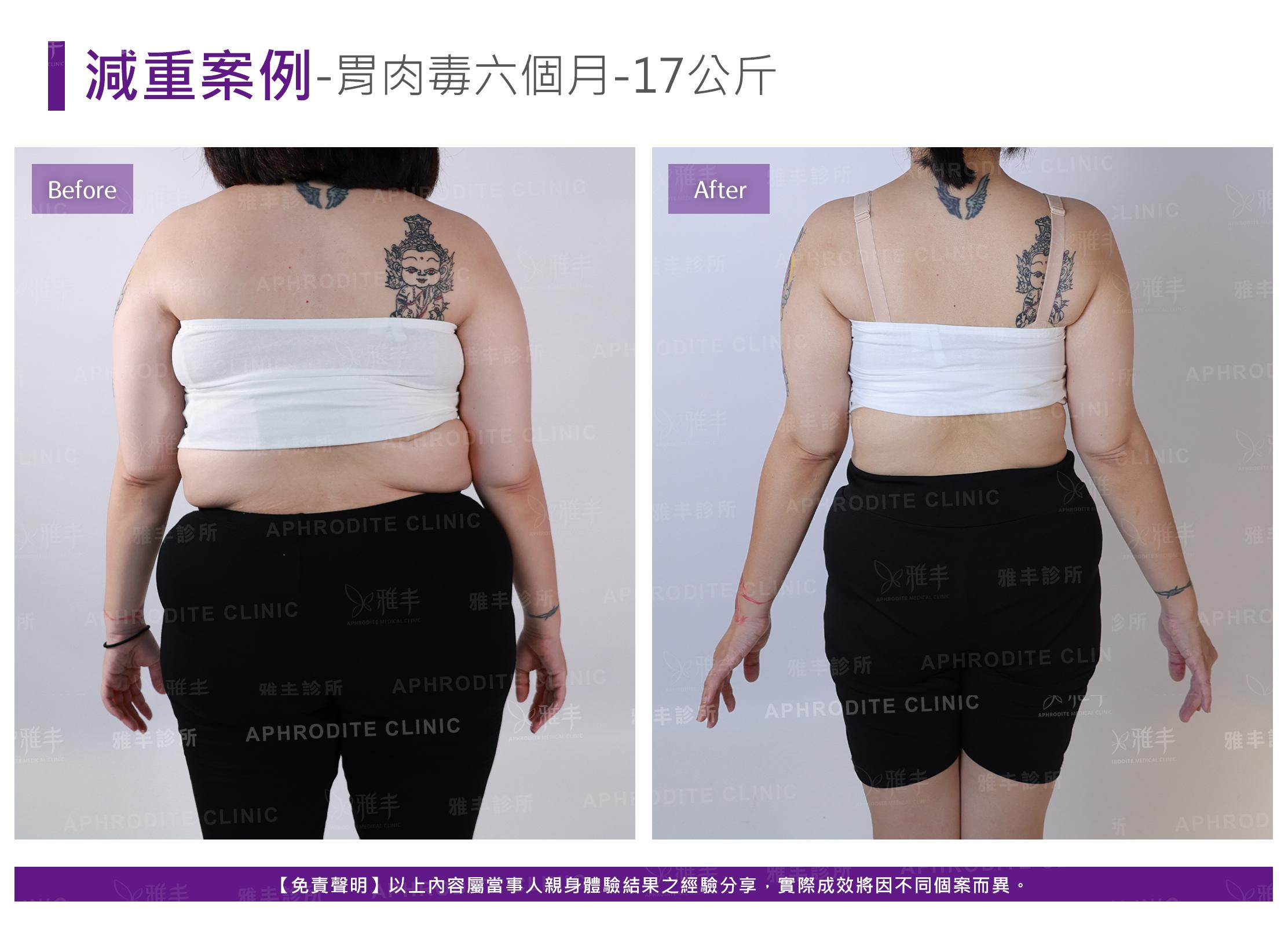 減重案例-case6-B.jpg
