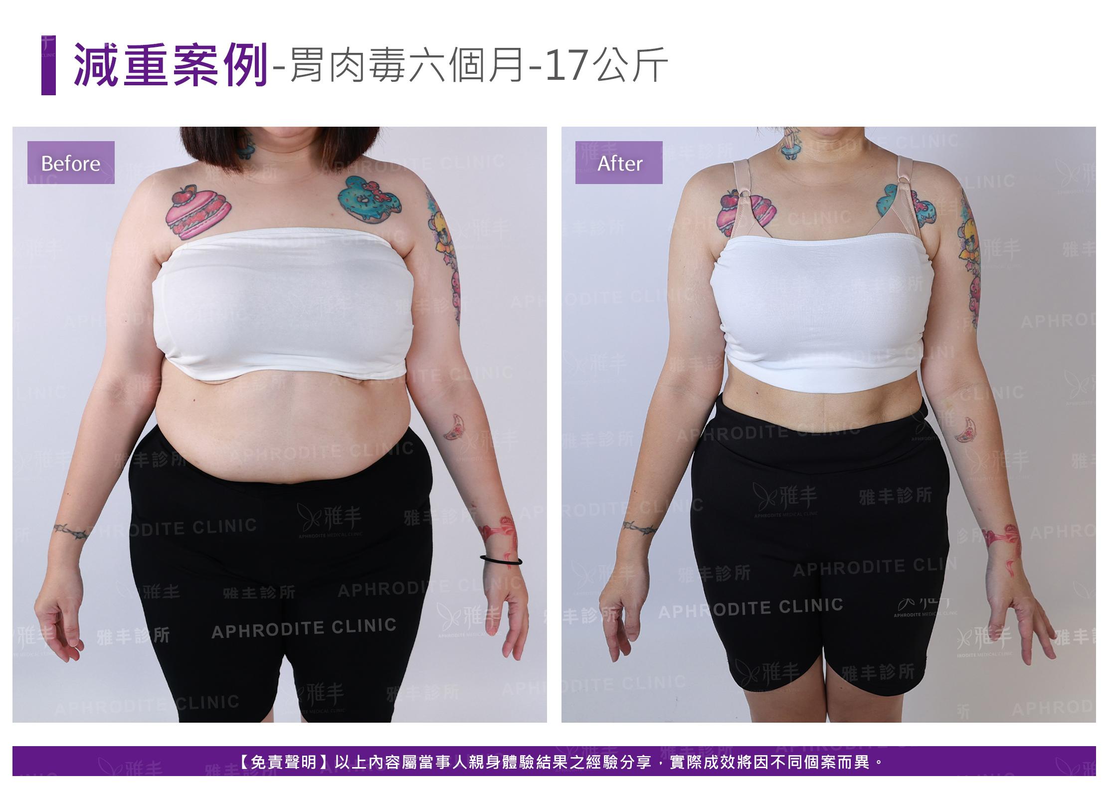 減重案例-case6-F.jpg