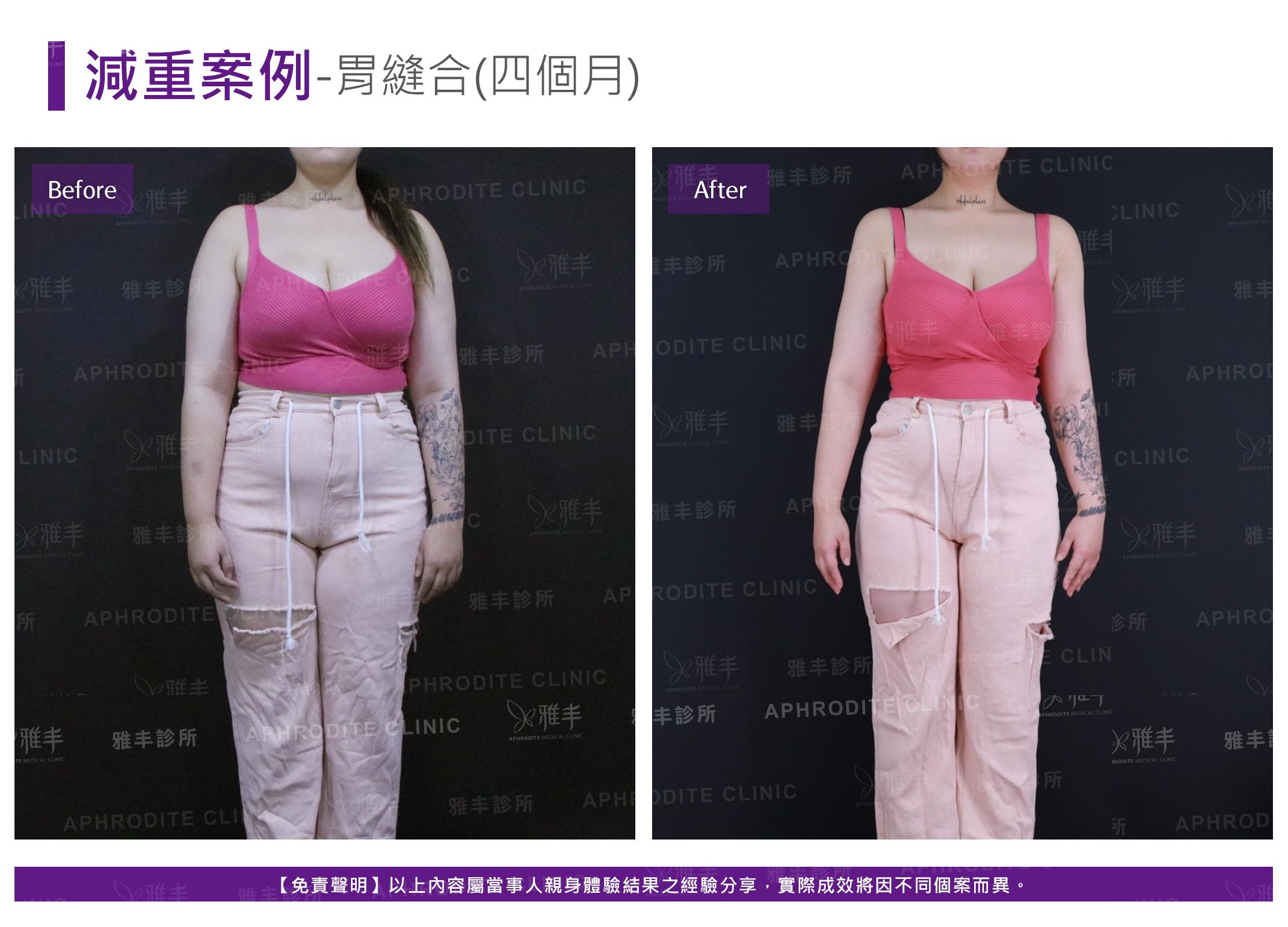減重案例-case7-F.jpg