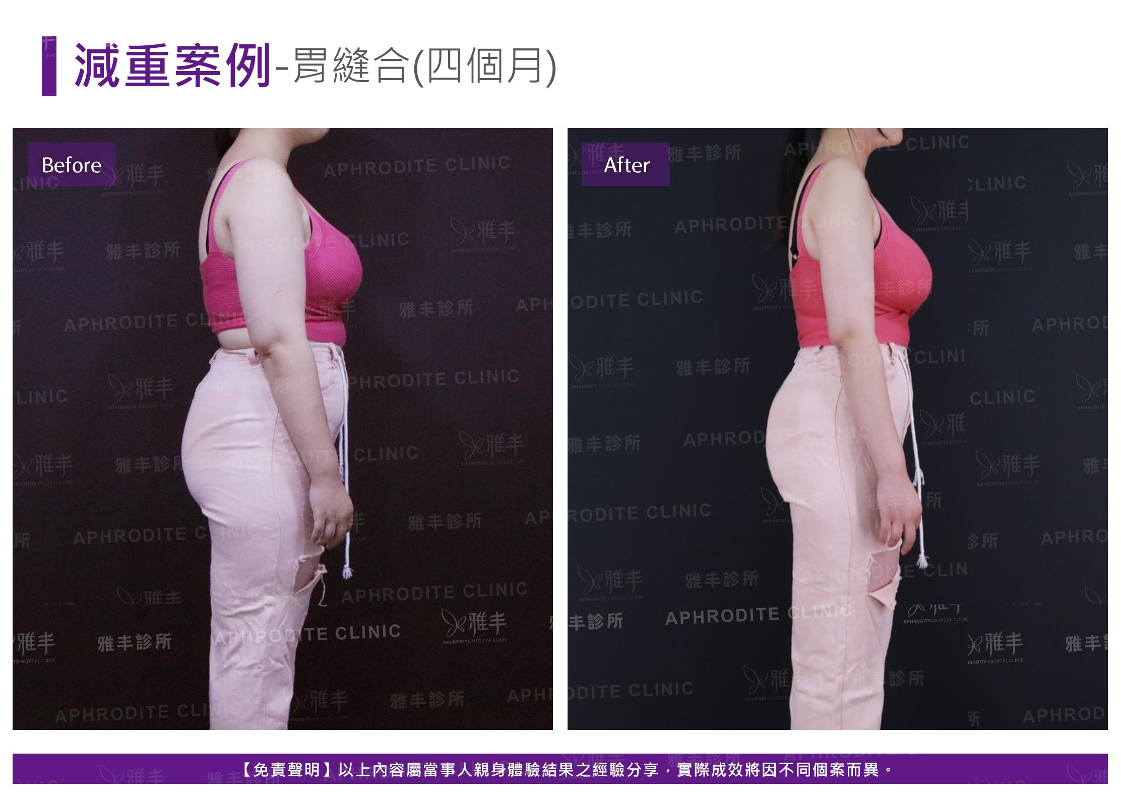 減重案例-case7-R90.jpg