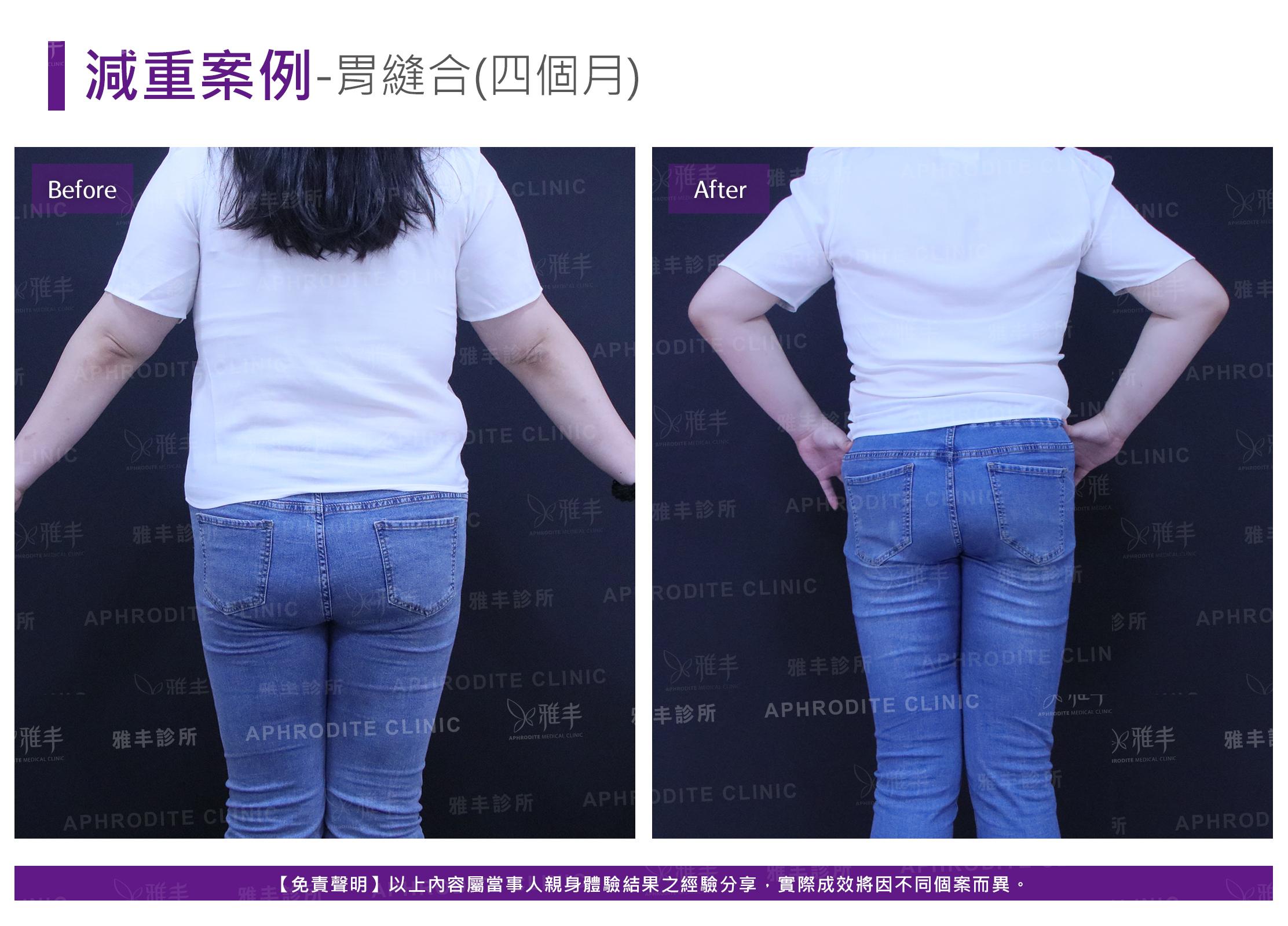 減重案例-case8-B.jpg