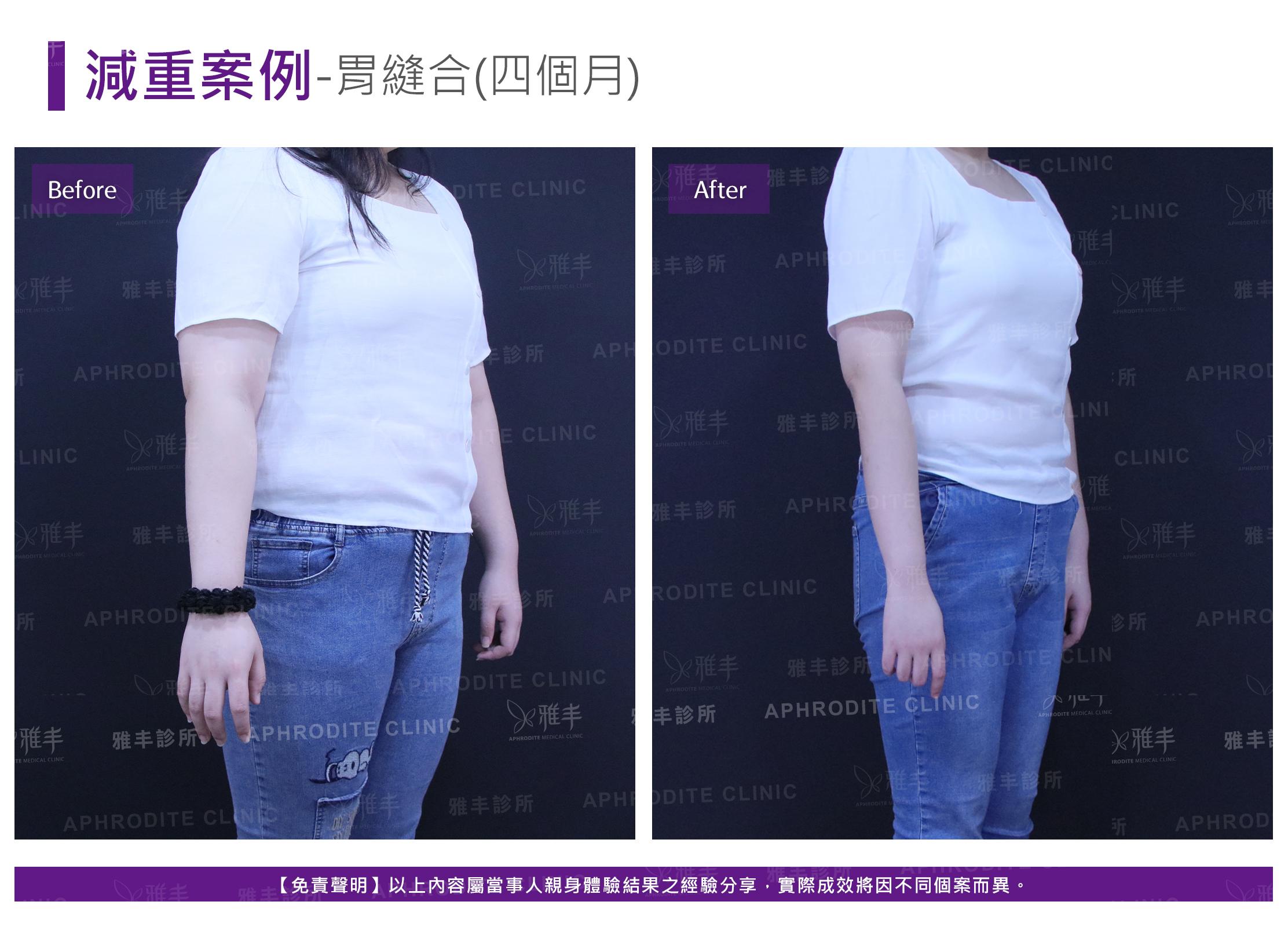 減重案例-case8-R45.jpg