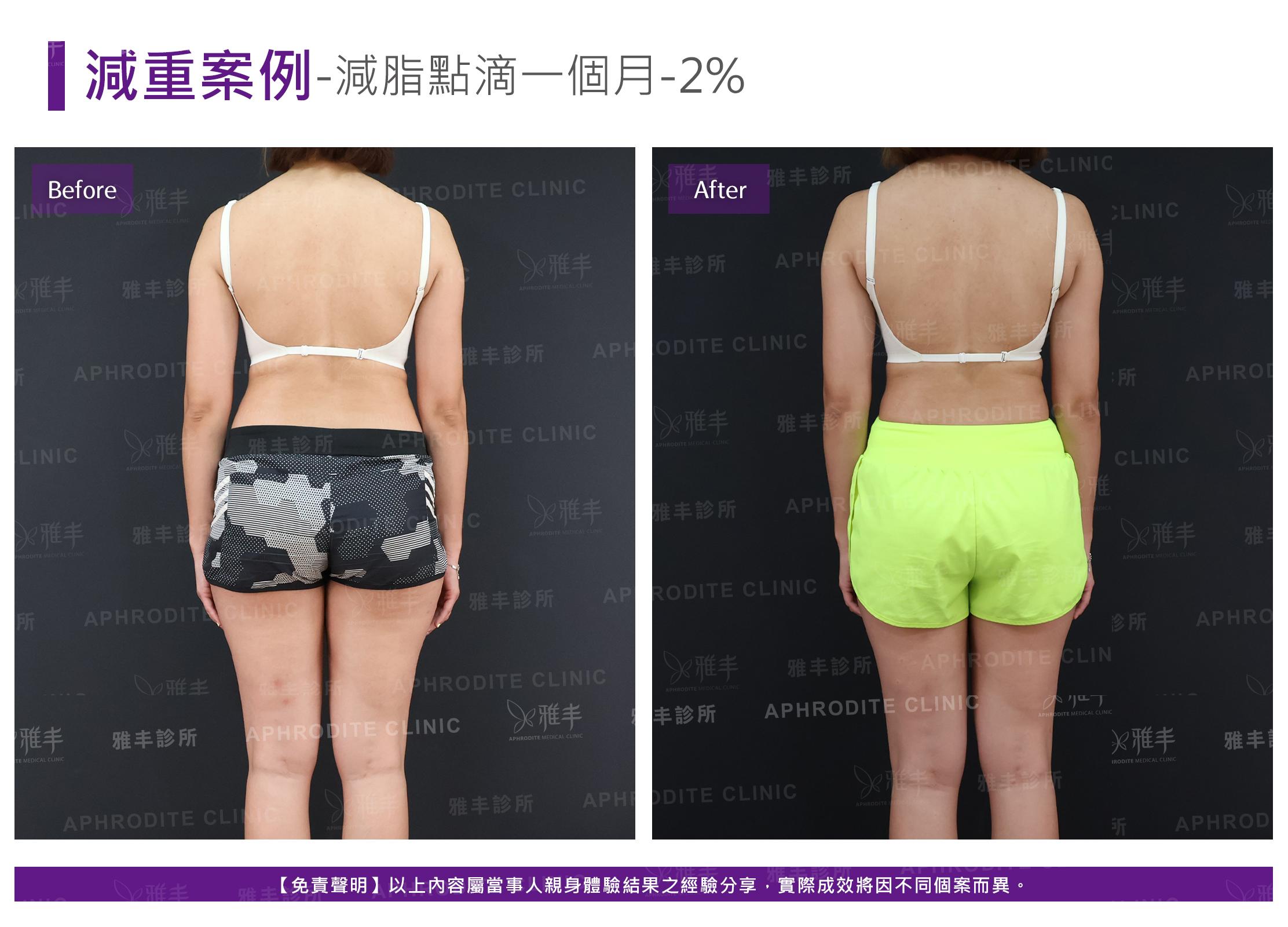 減重案例-case9-B.jpg