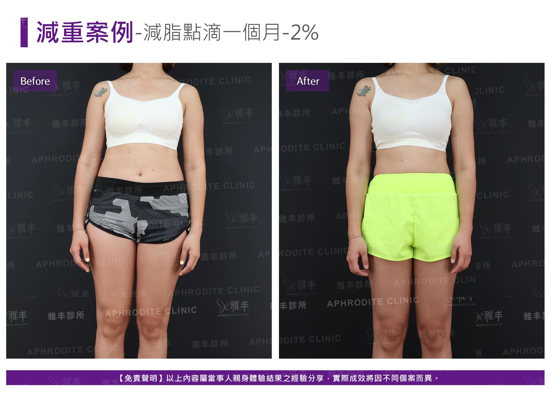 減重案例-case9-F.jpg