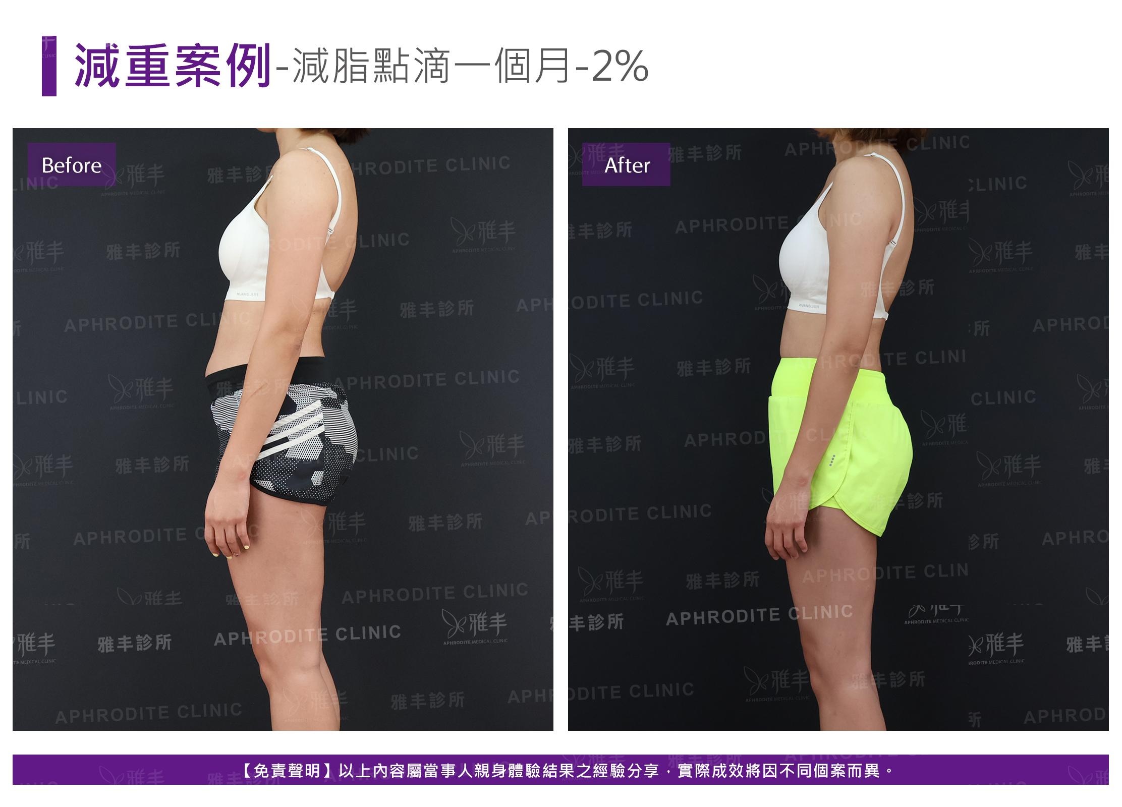 減重案例-case9-L90.jpg