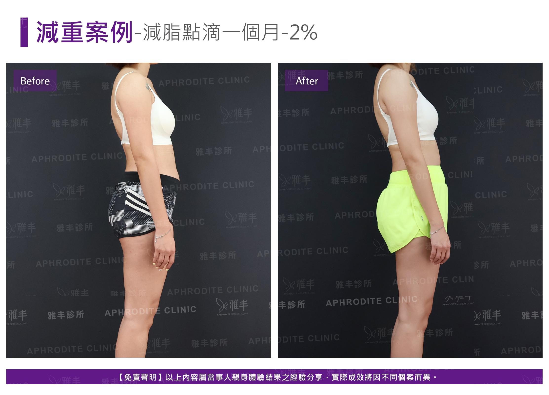 減重案例-case9-R90.jpg
