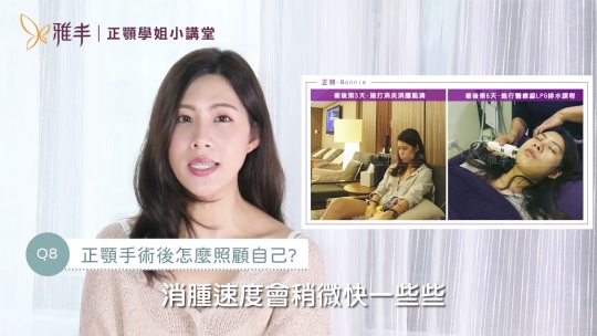 Embedded thumbnail for 正顎手術有後遺症嗎?正顎術後恢復期?正顎手術會痛嗎? │正顎手術的10個Q&amp;A-Part.2│雅丰正顎學姊開講