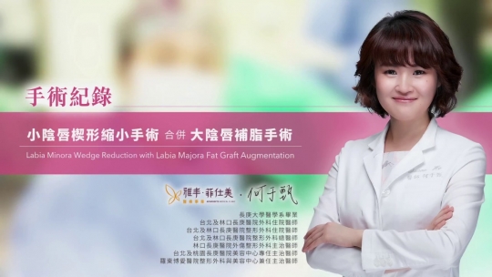 Embedded thumbnail for 【私密處整形】女性私密處構造講解及整形手術介紹