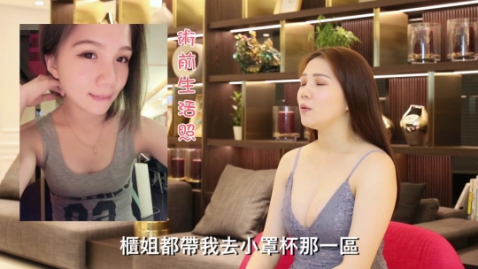 Embedded thumbnail for 【隆乳手術】何于甄醫師｜美胸女孩術後分享『我要變得更美麗』