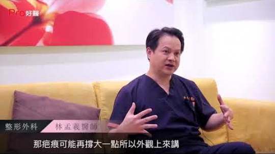 Embedded thumbnail for 【pro好醫大聯盟】產後肚皮鬆弛,如果做了腹部拉皮對再次懷孕會有影響嗎？