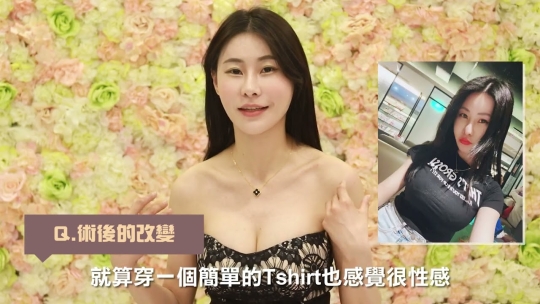 Embedded thumbnail for 後天巨乳養成–減重造成胸部萎縮的隆乳心得分享│雅丰隆乳案例