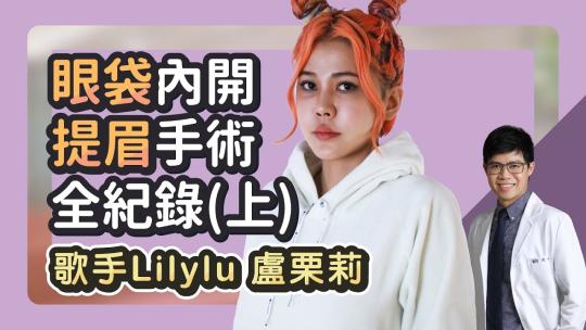 Embedded thumbnail for 眼袋內開、提眉手術全紀錄！Lilylu盧栗莉（上）｜雅丰診所 陳承謙醫師 feat.Lilylu盧栗莉