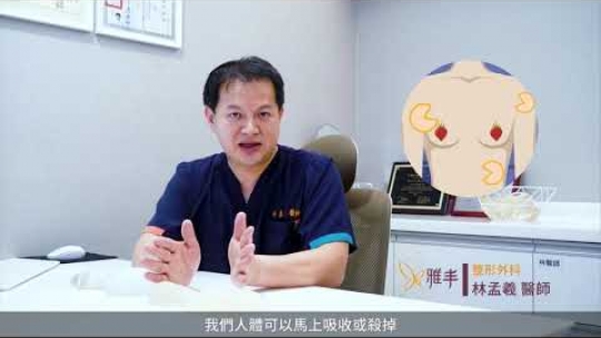 Embedded thumbnail for 【隆乳手術】林孟羲醫師｜為甚麼會有莢膜攣縮？原因是甚麼？如何預防？