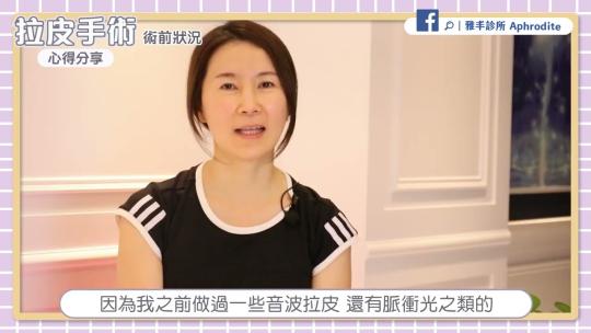 Embedded thumbnail for 拒絕眼皮下垂！拉緊皮膚找回年輕，拉皮手術心得分享│雅丰診所