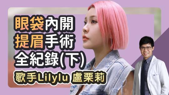 Embedded thumbnail for 眼袋內開、提眉手術全紀錄！Lilylu盧栗莉（下）｜雅丰診所 陳承謙醫師 feat.Lilylu盧栗莉