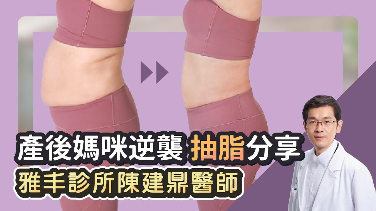 Embedded thumbnail for 二寶媽產後逆襲！產後媽咪計畫 給自己一次變身的機會｜雅丰診所 陳建鼎醫師