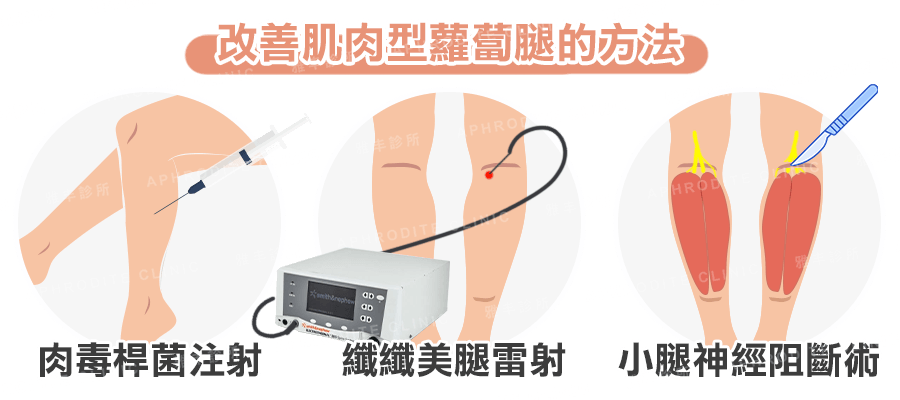 瘦小腿的方法,纖纖美腿,肉毒注射,小腿神經阻斷